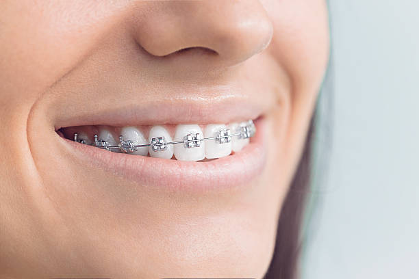 Best Dental Fillings (Composite and Amalgam)  in East Hills, NY